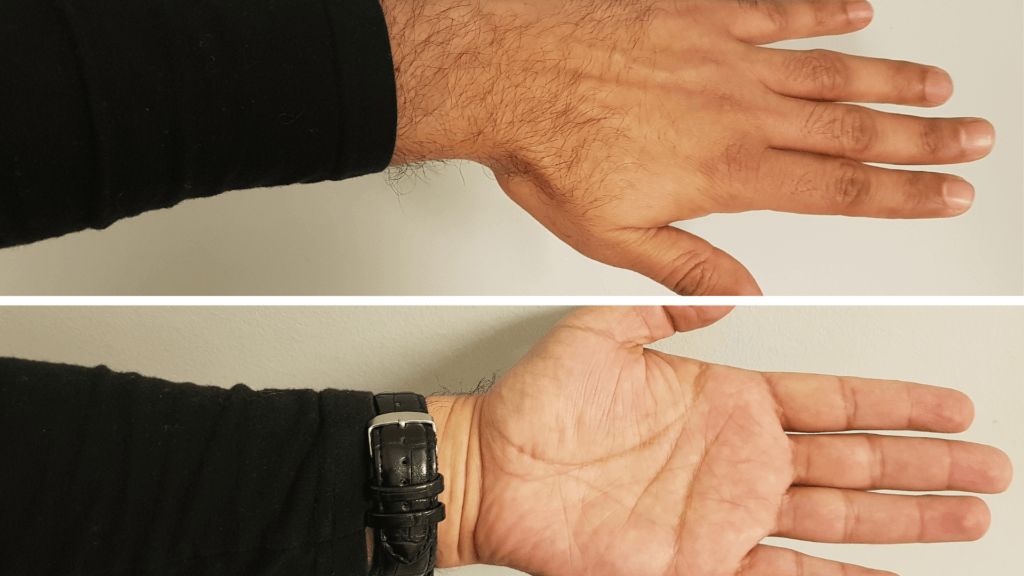 hand exercise for tremor